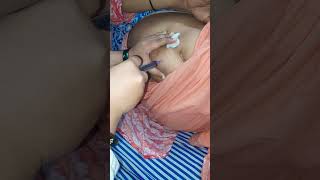 intramuscular Injection video full vlog [upl. by Audres]