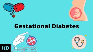 Gestational Diabetes Everything You Need to Know [upl. by Lingwood]