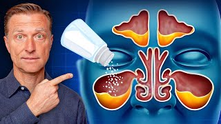 Rid Throat and Sinus Mucus with SALT [upl. by Deraj335]