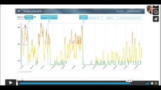 Ceribell EEG Enables Bedside Seizure Detection and Medication Management [upl. by Leiru]