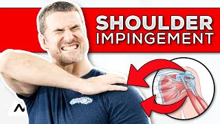 FIX Shoulder Pain  5 Shoulder Impingement Exercises [upl. by Shanan]