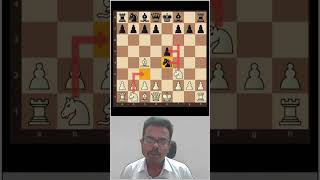 Robinson vs Davis 1916mate in 10 Moves  chess Tricks to win fast Tamil chess chessgame [upl. by Shelby122]