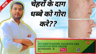 Batnovate n CreamBetamethasone valerate and neomycin cream  Skin cream [upl. by Fabiola]