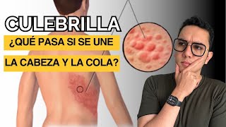 Culebrilla ¿Qué sucede si se une la cabeza con la cola Herpes zoster  Dr William Guerrero [upl. by Jarad887]