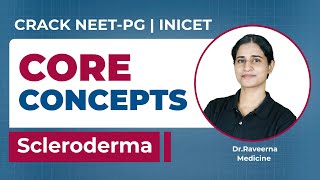 Medico Core Concepts Scleroderma Dr Raveerna [upl. by Kiryt]