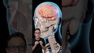 Concussão Cerebral 😱medicina medico enfermagem enfermeiro enfermeira neurologia nocaute boxe [upl. by Nonahs464]