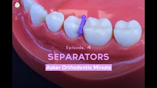 Separators Asker Orthodontic Minute Episode 4 [upl. by Arnaldo]