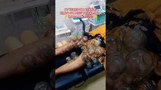 Knee Pain🦵Relief For Fire🔥Cupping Therapy👌 kneepain calf pain firecupping cupping shorts asmr [upl. by Elyrrad199]