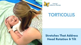 Torticollis 2 Stretches To Try At Home [upl. by Anaderol]