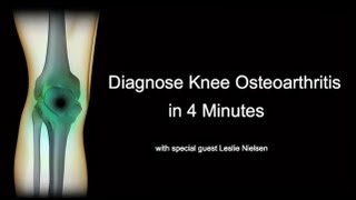 Diagnose Knee Osteoarthritis in 4 Minutes with Leslie Nielsen [upl. by Enived]