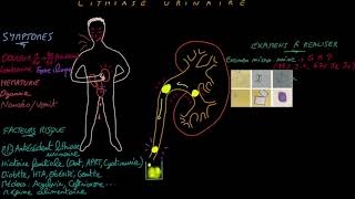 Lithiase urinaire  Docteur Synapse [upl. by Bruns]