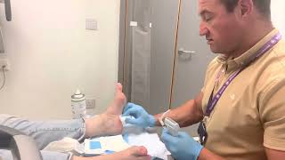 Plantar fasciitis injection by ultrasound guidance with local anaesthesia [upl. by Ver]