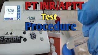 PT INR Test Procedure  Prothrombin Time  PT APTT Blood Test Procedure [upl. by Sparrow882]