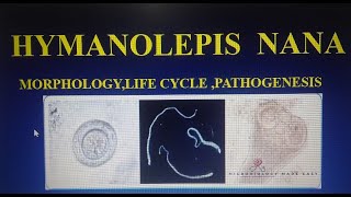 HYMENOLEPIS NANADWARF TAPE WORMMORPHOLOGY LIFECYCLE amp PATHOGENESIS [upl. by Yared380]