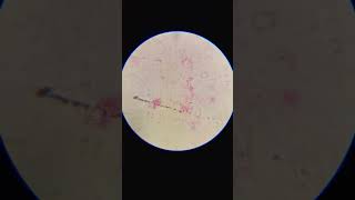 bacteria azotobacter under a microscope science biology [upl. by Kovacev]