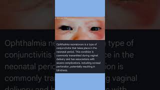 What is Ophthalmia Neonatorum [upl. by Ahslek]