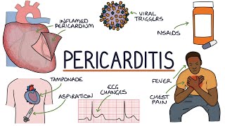 Understanding Pericarditis [upl. by Oretos611]