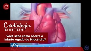 Você sabe como ocorre o Infarto Agudo do Miocárdio [upl. by Elmo]