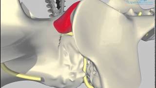 Lumbosacral distraction stabilisation surgical technique developed by Noel Fitzpatrick [upl. by Montagna]