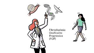 Saiba mais sobre Fibrodisplasia Ossificante Progressiva FOP [upl. by Aioj471]