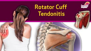 Rotator Cuff Tendonitis [upl. by Sauers]