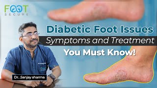 Diabetic Foot Treatment  Symptoms of Diabetic foot  Podiatric surgeon in Bangalore [upl. by Anotyal]