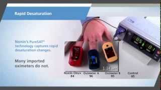 Nonin Onyx Vantage Finger Pulse Oximeter [upl. by Yrrat]