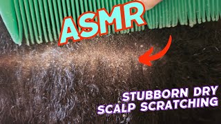 ASMR  FLAKY DRY SCALP SCRATCHING  VERY SATISFYING 😌 [upl. by Latvina]