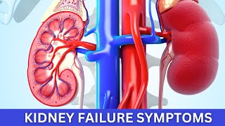 KIDNEY FAILURE Symptoms You Need to Know RIGHT NOW [upl. by Haggerty884]