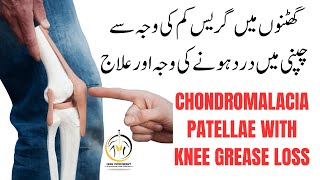 Best Exercise for Chondromalacia Patella  Jumpers Knee  Runners Knee Pain  Patellar Tendinitis [upl. by Elata]