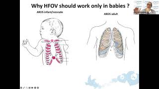 High Frequency Oscillatory Ventilation for Infants in the PICU Understanding When and How [upl. by Ahsietal]