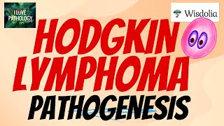 HODGKIN LYMPHOMA  PATHOGENESIS  ReedSternberg Cell [upl. by Artekal]