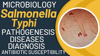 Salmonella typhi microbiology  Typhoid fever pathogenesis by salmonella typhimurium [upl. by Notgnilra]