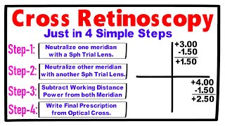 Cross Retinoscopy just in 4 Simple Steps [upl. by Blanchette]