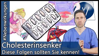 Nehmen Sie Cholesterinsenker Achten Sie auf diese Gefahren amp Nebenwirkungen [upl. by Guerra]