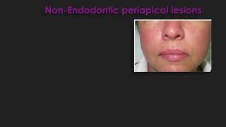 Periapical Neoplastic Lesions Prof Rania Othman [upl. by Gulgee820]