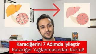 Karaciğerini 7 Adımda İyileştir Karaciğer Yağlanması Tanı ve Tedavisi [upl. by Washko996]