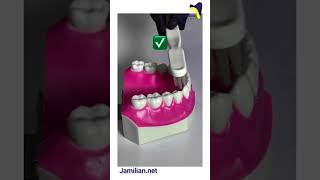 Effective Tooth Brushing Techniquesorthodontics dentist orthodontistbrushing toothpaste brush [upl. by Aseretairam152]