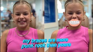 Reese Gets Braces  The LeRoys [upl. by Farrar]