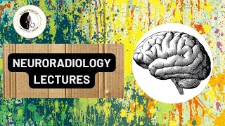 Trigeminal neuralgia  Dr Ahmed ElAgamy [upl. by Yila]