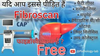 FIBROSCAN OF LIVER  फाइब्रोस्कैन kaise hota hai dheko फाइब्रोस्कैन क्या है  tranding shortvideo [upl. by Artemahs]