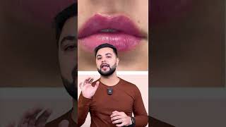 Transform Your Lips 100 Effective Dark Lip Pigmentation Treatment at Home [upl. by Hannaj332]