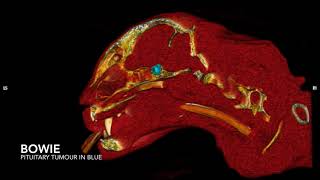 Pituitary gland tumour CT 3D Reconstruction  The first successful hypophysectomy in Australia [upl. by Audres]