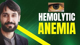 Hemolytic Anemia  Causes  Symptoms  Diagnosis and Treatment  MLT Hub with kamran [upl. by Sihonn332]