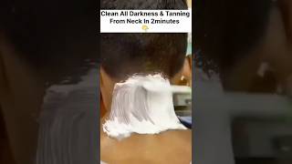 Dark Neck Home Remedies  Neck Cleaning Tips  Easy Neck Tanning Removal Pack [upl. by Karita]