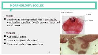 Parasitology Cestodes Part 2 [upl. by Eusoj]