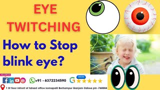 How to Stop EYE twitchingwhat cause twitching eyelidHow get rid of twitching eyelidstop blink eye [upl. by Ginsburg]