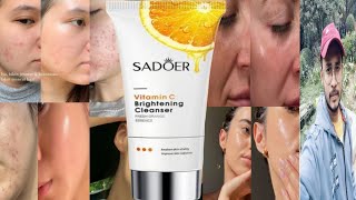 Sadoer Vitamin C Brightening Cleanser  Honest Review [upl. by Wistrup284]