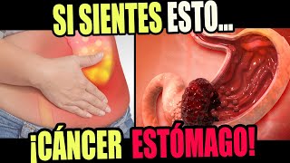 Si SIENTES esto TIENES CANCER de ESTOMAGO  SÍNTOMAS INICIALES DEL CANCER DE ESTÓMAGO [upl. by Olecram68]