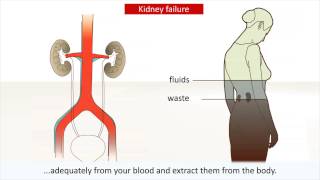 Kidney disease  Causes and treatment of kidney failure [upl. by Oenire366]